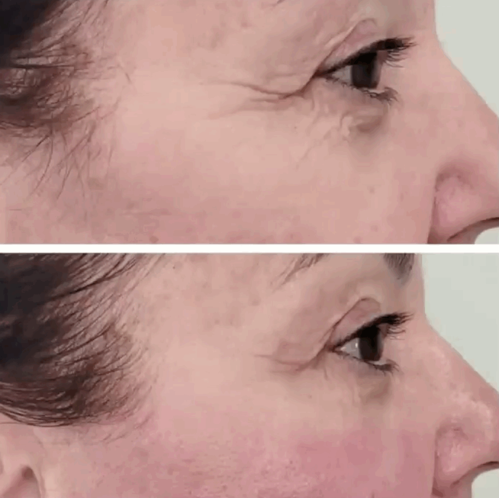 PRX Professional - Eyes Results