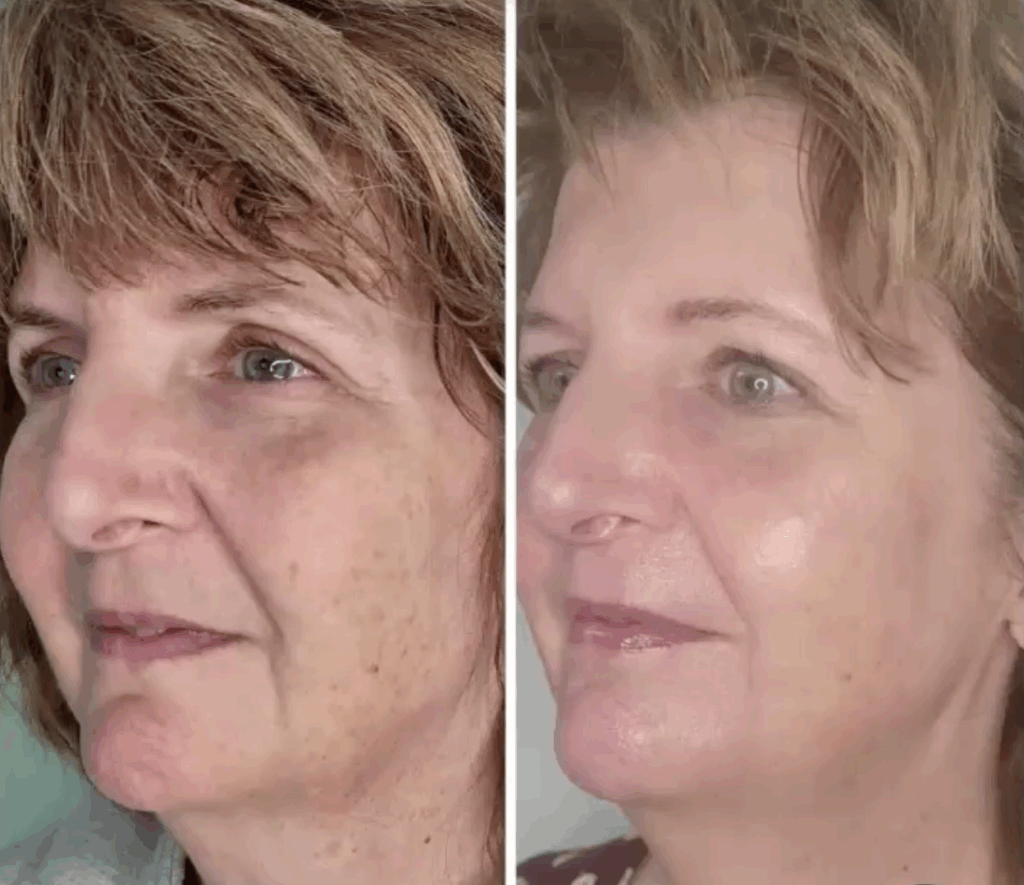 PRX Professional - Face Result